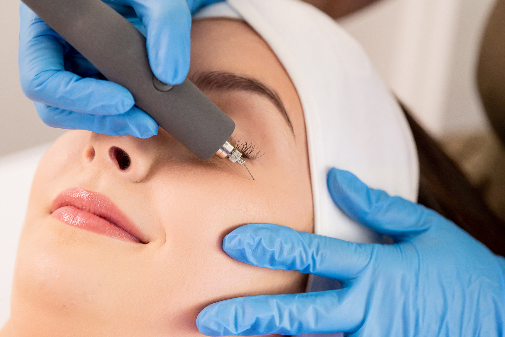 subnovii plasma pen treatment