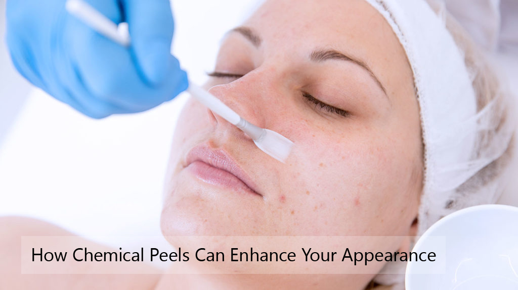 Chemical Peels